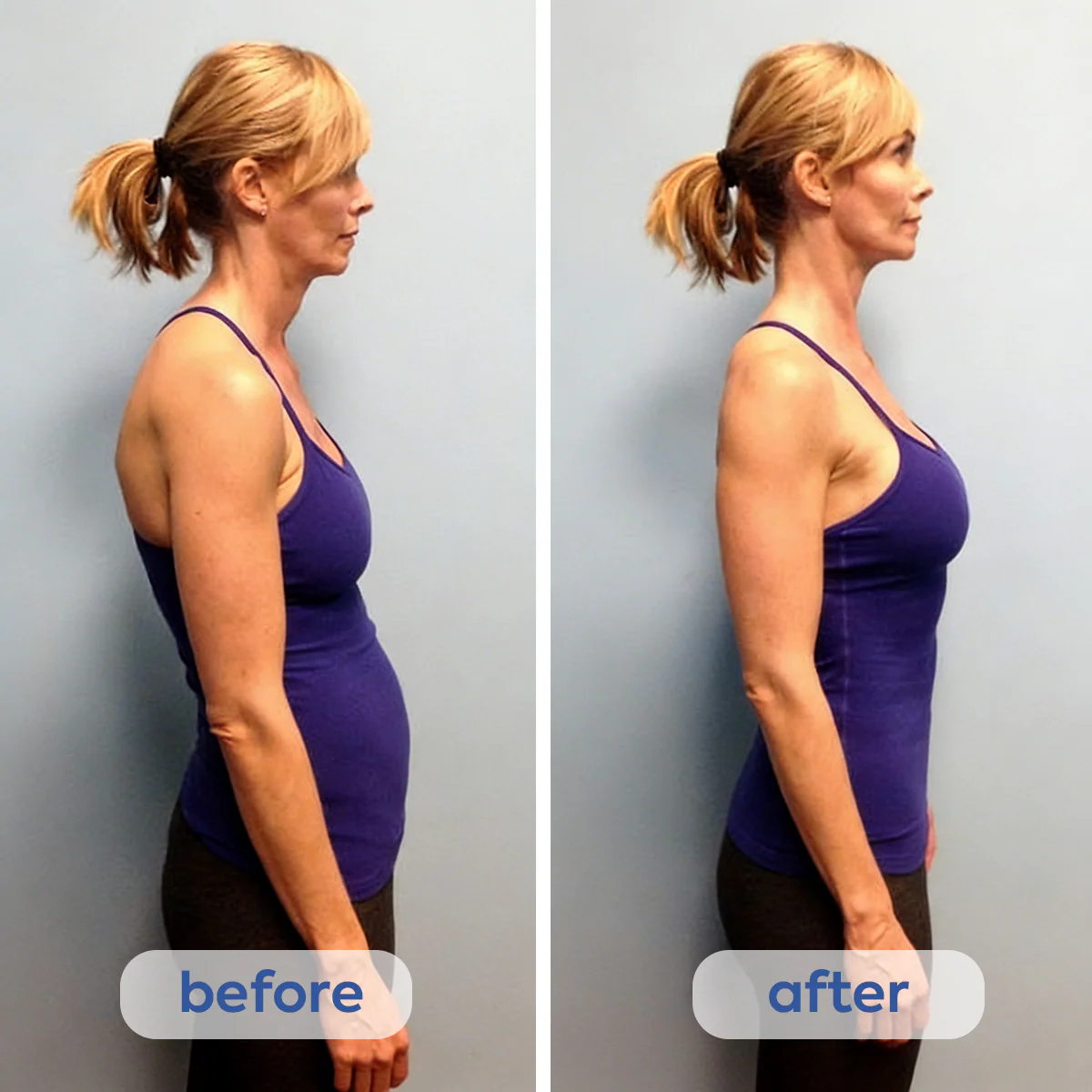 Instant Posture Corrector - Image 2
